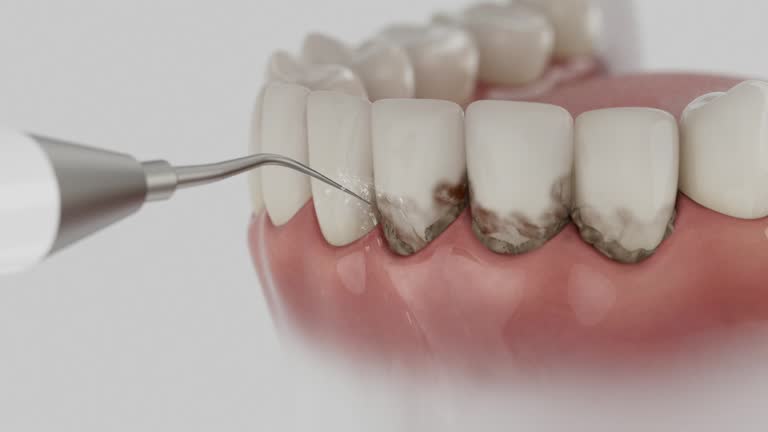 Reliable Dental contractor in Clarksburg, MD by Dentist Open Now